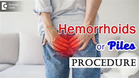 Hemorrhoids Or Piles Procedure Video Dr Rajasekhar M R Youtube