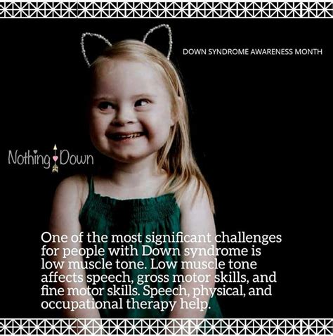 Pin On Down Syndrome Awareness Month Infographics