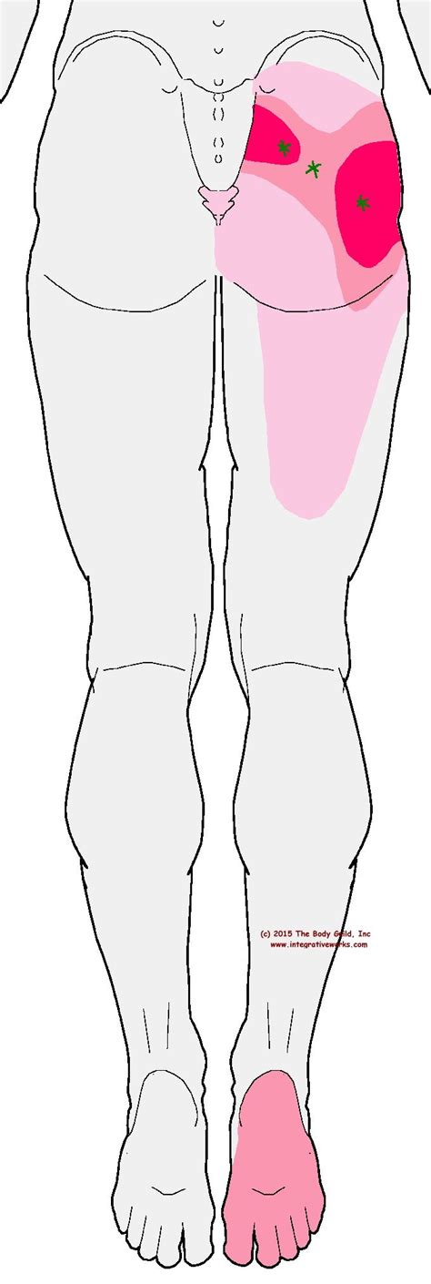 Discover the benefits of massage therapy and how it can help ease sciatica pain. Pin on Sciatica Nerve Pain Remedies