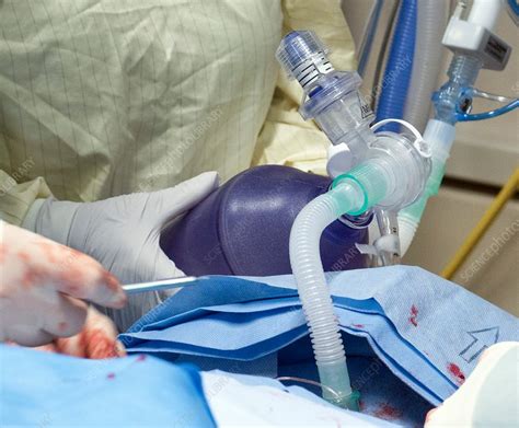 Ventilating A Tracheostomy Patient Stock Image C Science Photo Library