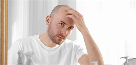 A Cure For Baldness? Doctors Might Finally Have It - Style ...