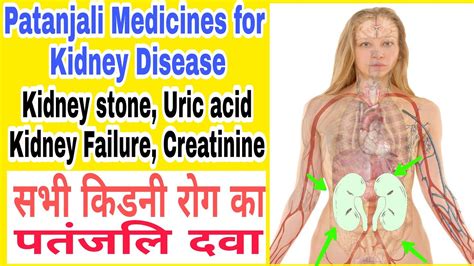 Patanjali Medicine For Kidney Disease Kidney Stone And Chronic Kidney