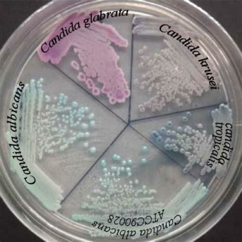 Differentiation Of Various Species Of Candida On Chrom Agar Download