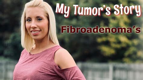 My Story Fibroadenoma Tumors Unexpected Prolactin Check Youtube