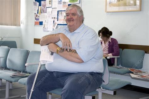 Obesity Clinic Patient Stock Image C0014517 Science Photo Library