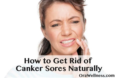 How To Heal Canker Sores Naturally Wellness Media