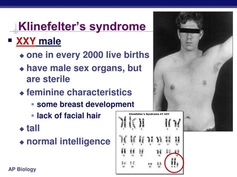 ppt ch 15 errors of meiosis chromosomal abnormalities powerpoint presentation id 2171051