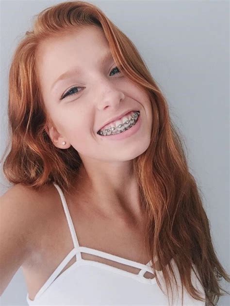 Mostly Reds Redheads Stunningly Beautiful Freckles