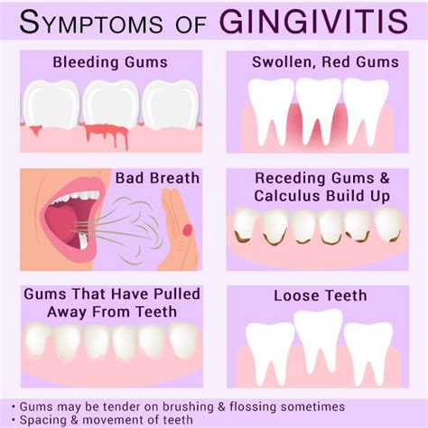 Gingivite 101 Types Causes Traitement Et Facteurs De Risque Haum