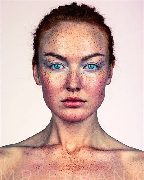 Stunning Portraits Celebrate The Unique Beauty Of Freckled Faces