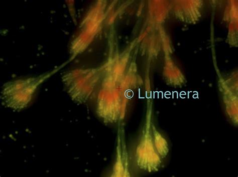 Microscope World Blog Penicillium Mold Under A Fluorescence Microscope