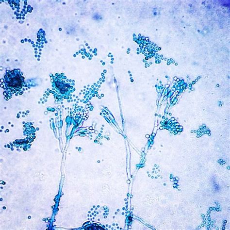 Check spelling or type a new query. Lactophenol Cotton Blue Stain of Penicillium Species ...