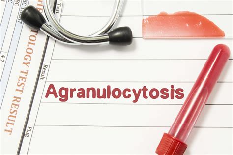 Cme Activity Agranulocytosis Mds And Pas