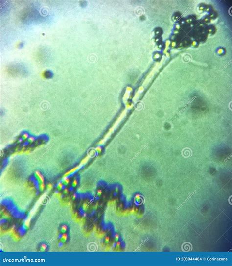 Penicillium Genus Mold Fungal Spores Mycelium Under The Microcope Stock