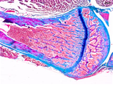Filopodia from adjacent osteocytes communicate via gap junctions. Bone Zoom Gallery | Ask A Biologist