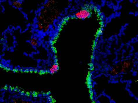 Lung cell found to act as sensor, regulator of immune response