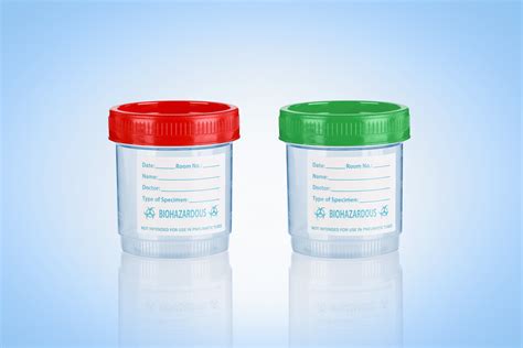 Sample Containerurine Containerspecimen Containerurine Sample