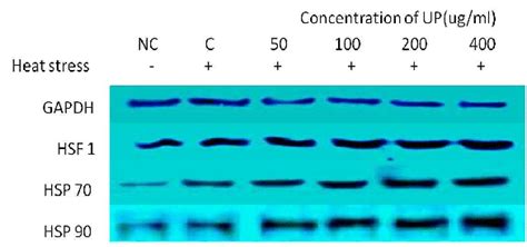 Write the complimentary mrna, trna, the amino acid sequence it codes for and the related trait in the chart below. Effect of UP on the protein expressions of heat stress related genes in... | Download Scientific ...