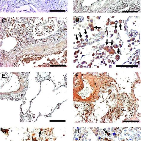 Representative Photomicrographs Of Pulmonary Tissue Sections From A