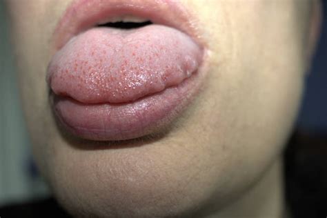 Scalloped Tongue Stock Photos Pictures And Royalty Free Images Istock