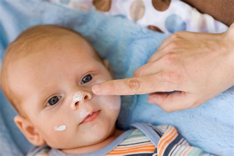 Como Curar Los Granitos En La Cara De Mi Bebé Quotes Viral