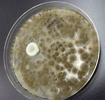 Image result for mold pictures