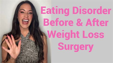 eating disorder before and after weight loss surgery 1 yr 9 mo post op rny gastric bypass