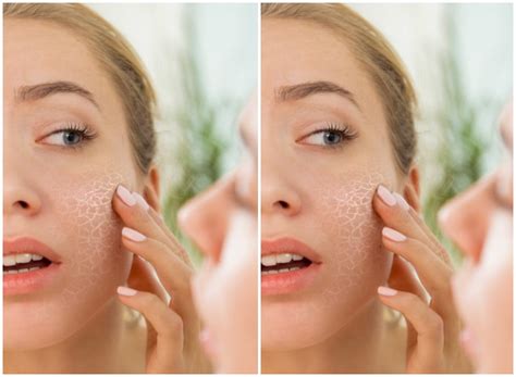 From Dry To Oily Skin Heres Your Ultimate Skin Care Guide For