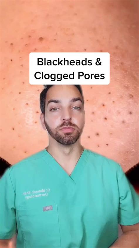 Blackheads And Clogged Pores Dermatologist Dermdoctor Learnontiktok