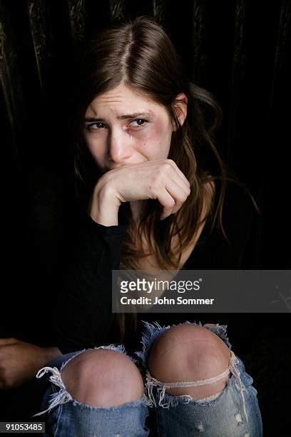 Teen Bruise Photos And Premium High Res Pictures Getty Images