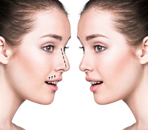 The 5 Most Popular Plastic Surgery Procedures For Women