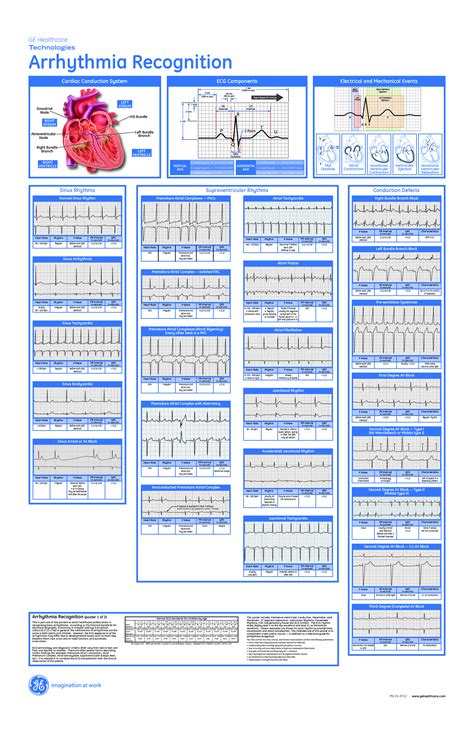 Arrhythmia Recognition Critical Care Nursing Cardiac Nursing Nurse