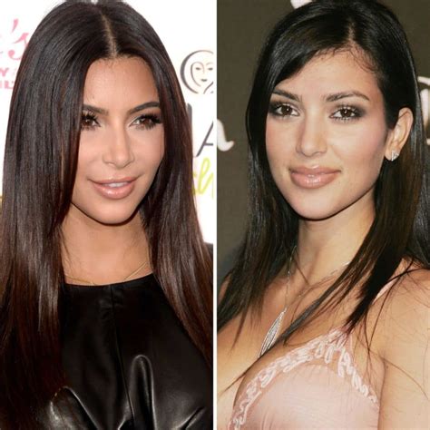 Kourtney Kardashian Before And After Plastic Surgery