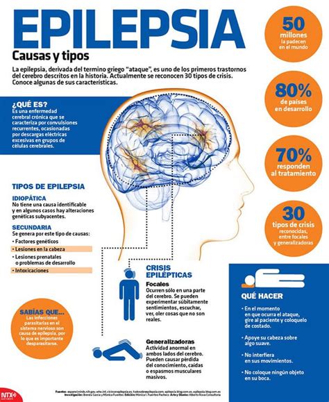 Aprender Con Una Imagen Guía Práctica Con Infografías Y S Epilepsia