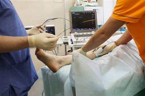 Endovenous Laser Therapy Evlt For Varicose Veins