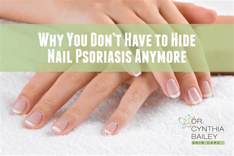 Treatment For Nail Psoriasis Why You Dont Have To Hide Nail Psoriasis