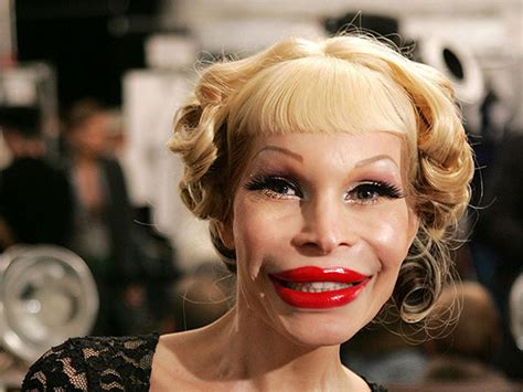 Plastic Surgery Gone Very Very Wrong14 Pics