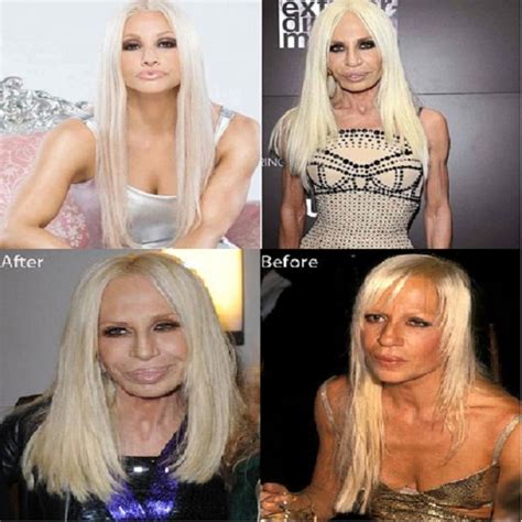 Donatella Versace Plastic Surgery Gone Wrong Brasizemeasurements Org