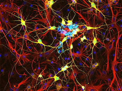 A fork in the road of human brain development