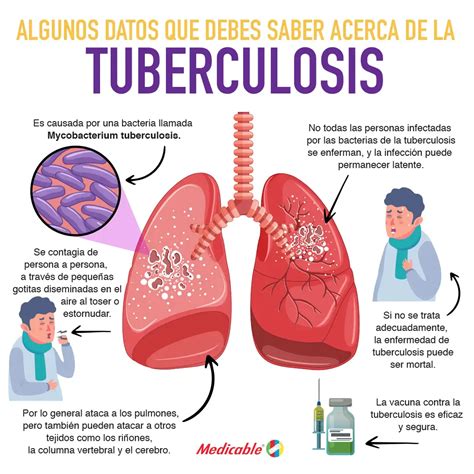 Algunos Datos Que Debes De Saber Sobre La Tuberculosis Medicable