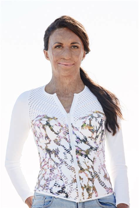 Next Week Turia Pitt Will Speak In Canberra About Doing The Impossible Hercanberra