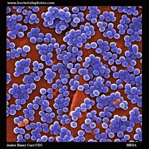 Wortellini Methicillin Resistant Staphylococcus Aureus Mrsa