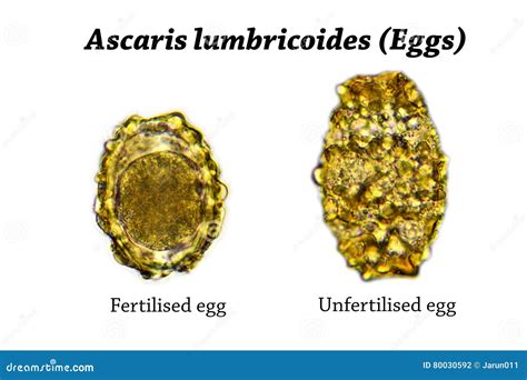 Ovos De Ascaris Lumbricoides