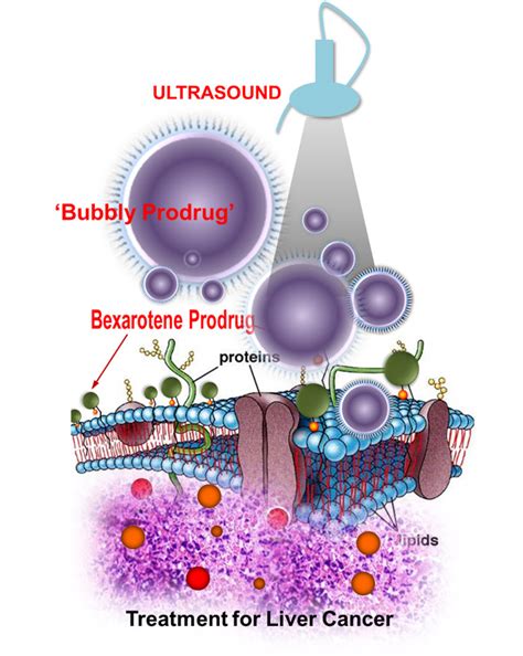 Researchers Use Ultrasound To Activate Cancer Killing Drugs