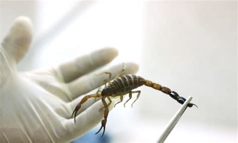 Dalam kerangka manusia itu terdapat beberapa jenis tulang pembentuk yang menyumbang 20% dari berat badan suatu tubuh manusia. 10 Foto Benda Termahal Dunia 2021 Pusaka Antik Langka Kuno