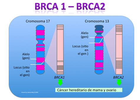 CÁncer De Mama Genes Y Cromosomas Implicadas