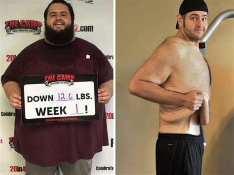 Skin Before And After Weight Loss Pictures Men