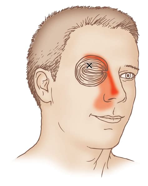 It has two major parts:the outer orbital part is a. Orbicularis oculi - Trigger Point - Learn Muscles