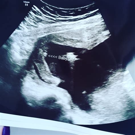 All babies are around the same size in very early pregnancy. Baby just gender scan girl but looks like boy