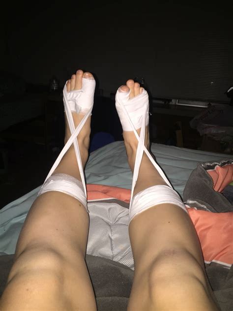 These exercises are some of the latest exercises physiotherapists and other health professionals recommend when patients have plantar fasciitis and/or heel pain. Pin on Rx